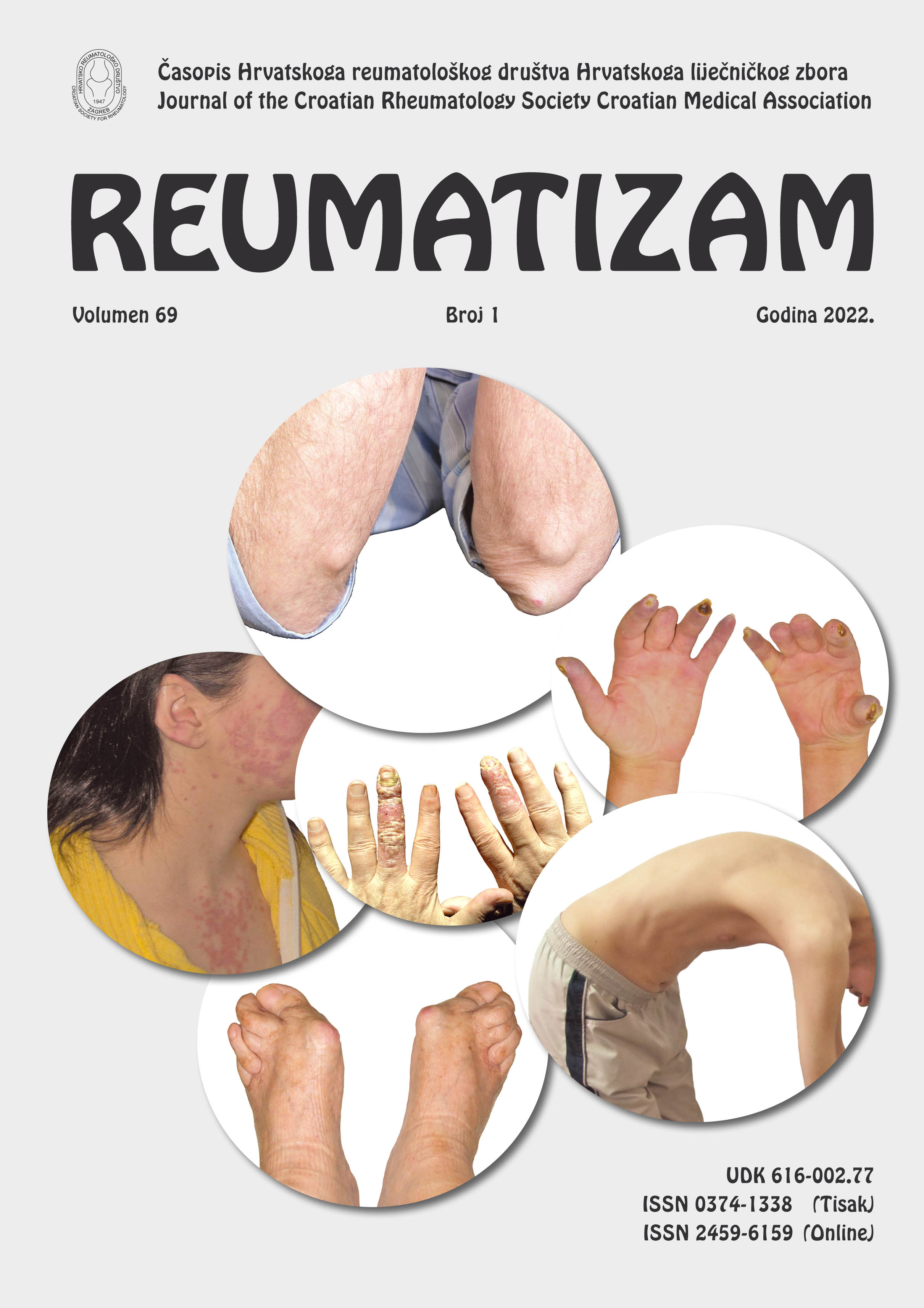 logo Reumatizam